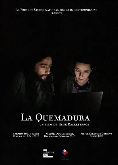 La quemadura