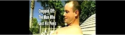 Chopped Off: The Man Who Lost His Penis
