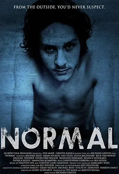 Normal