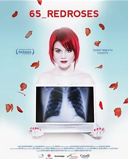 65_RedRoses