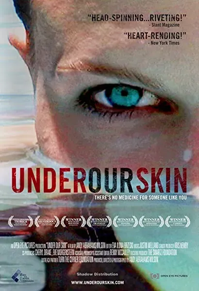 Under Our Skin