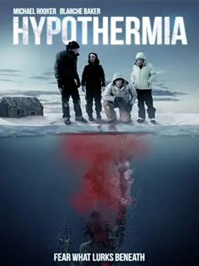 Hipotermia