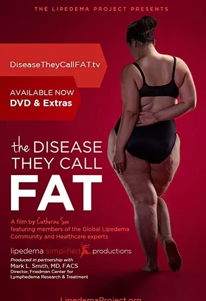 The Disease They Call FAT
