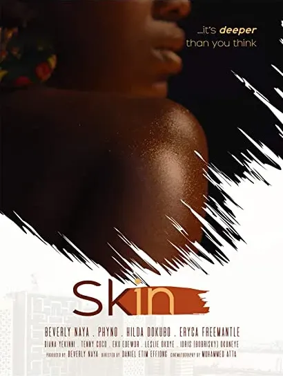 Skin