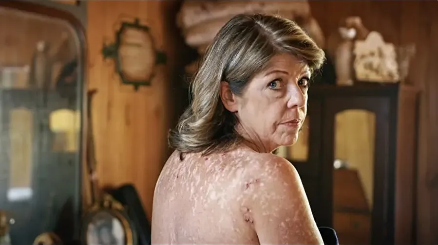 Skin Deep: The Battle Over Morgellons online