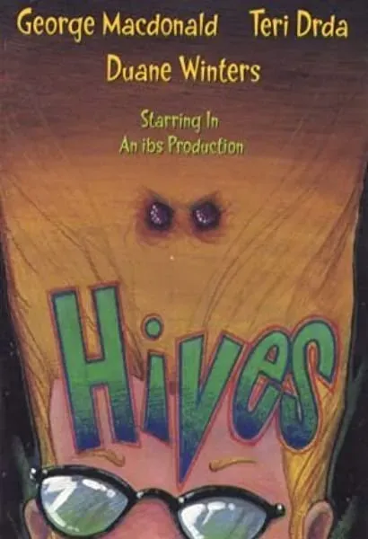 Hives