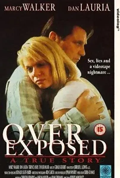 Overexposed
