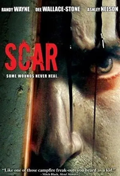 Scar