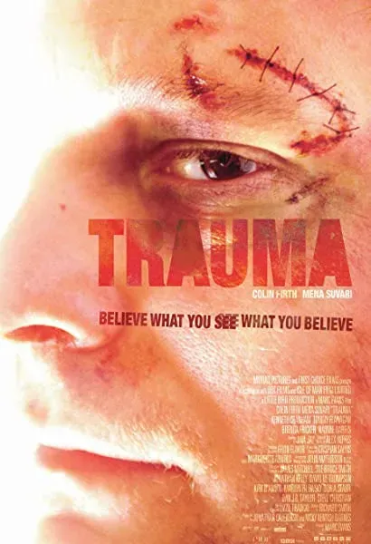 Trauma